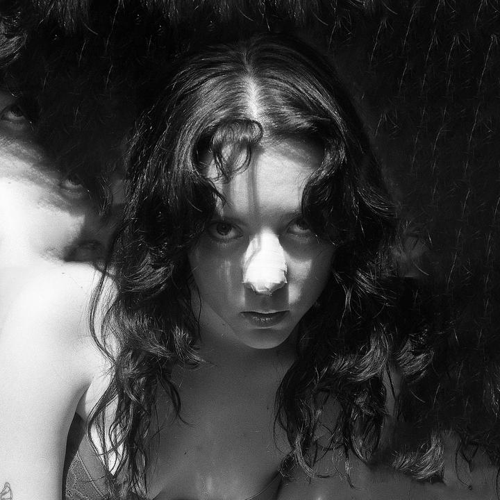 A woman with long, dark, curly hair looks directly at the viewer, with a bandage on her nose and a shadow across her face.